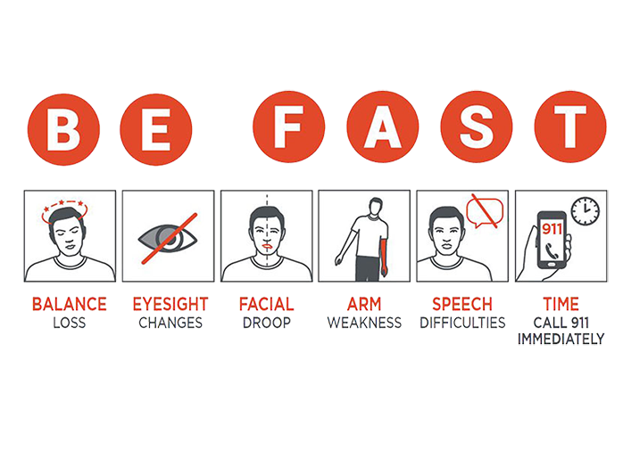 Be Fast: Balance loss, eyesight changes, facial droop, arm weakness, speech difficulties, time. Call 911 immediately.